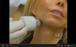 Alpha-Weight-Orlando-Apollo-Skin Tightening Video link